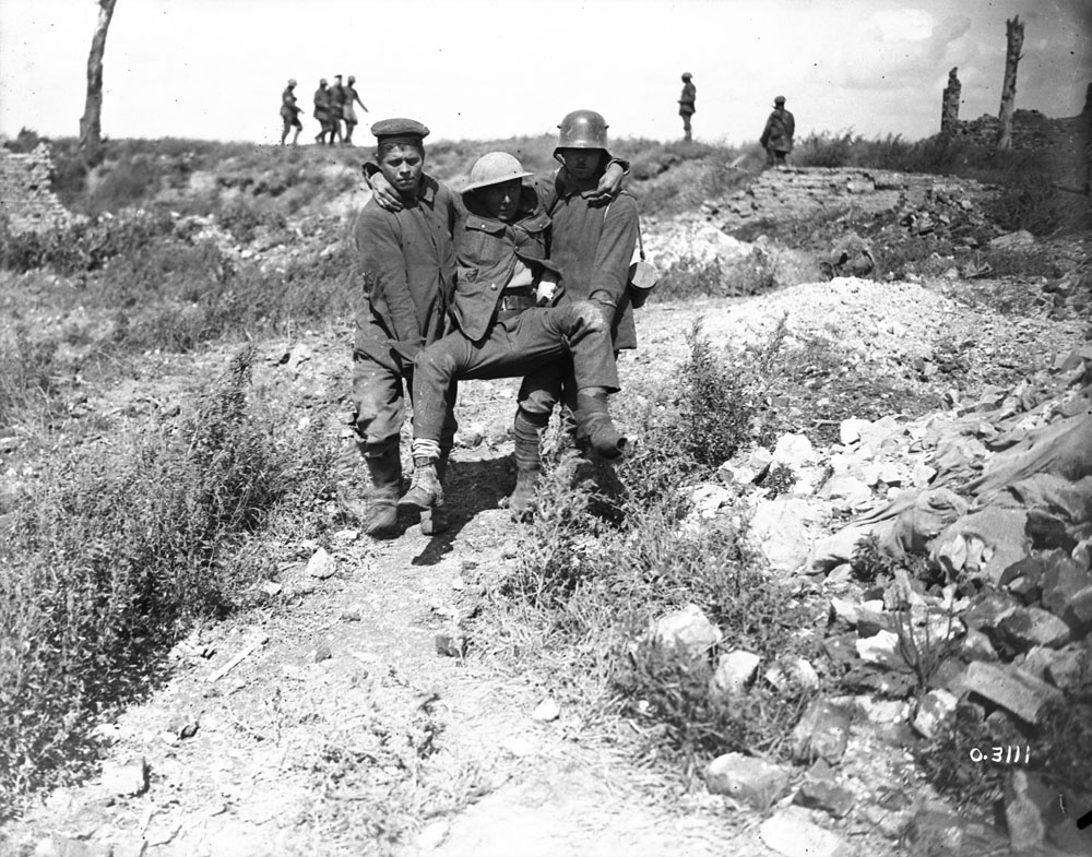 Battle of the Scarpe, 26 August 1918. Two very young prisoners carrying wounded Canadian. MIKAN No. 3403177