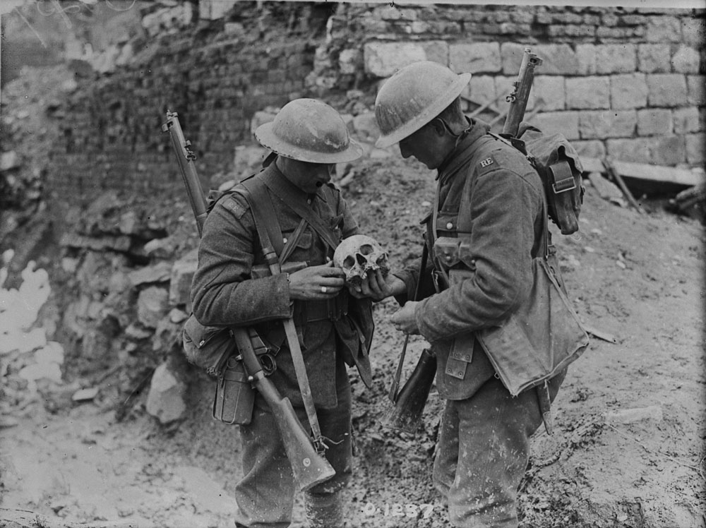 Examining a skull found on battlefield of Vimy Ridge